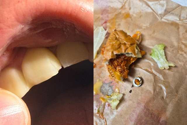 異物混入か自作自演か...ハンバーガーから金属ボルトに議論