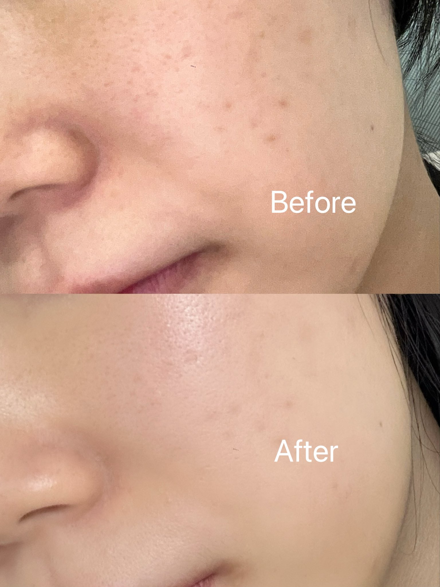 日本人ほぼいなくて正直不安だったけど大当たりだった韓国の皮膚科